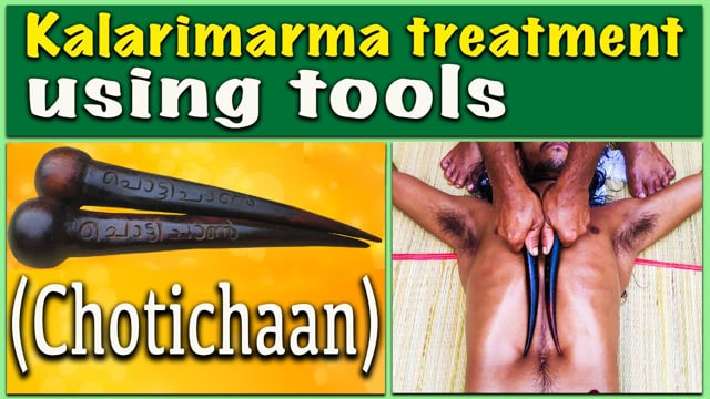 Tool therapy segment in Kalari marma therapy - chotichaan  (Duration : 02:34:17)